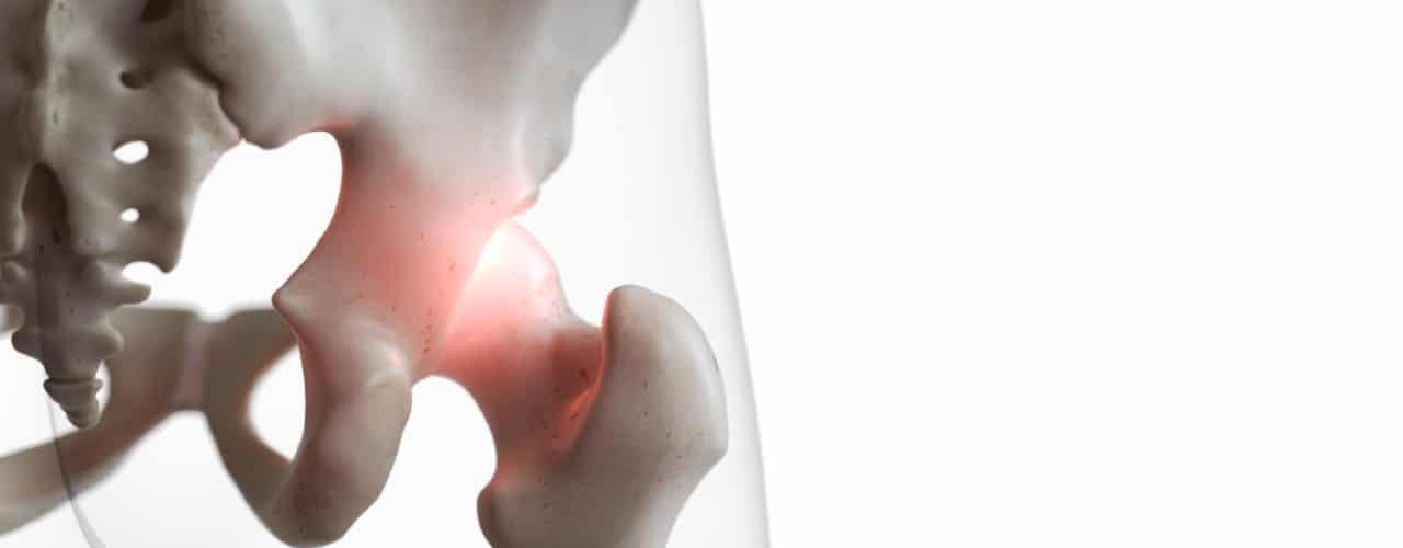 What is Sacroiliac Joint (SI Joint) Dysfunction?